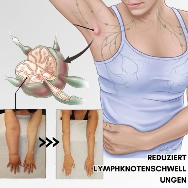 Lymphatic system stimulation ring