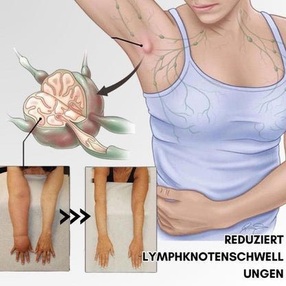 Lymphatic system stimulation ring